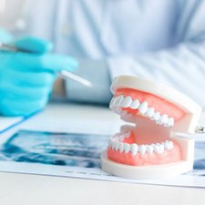 Model teeth sitting on a dentist’s desk